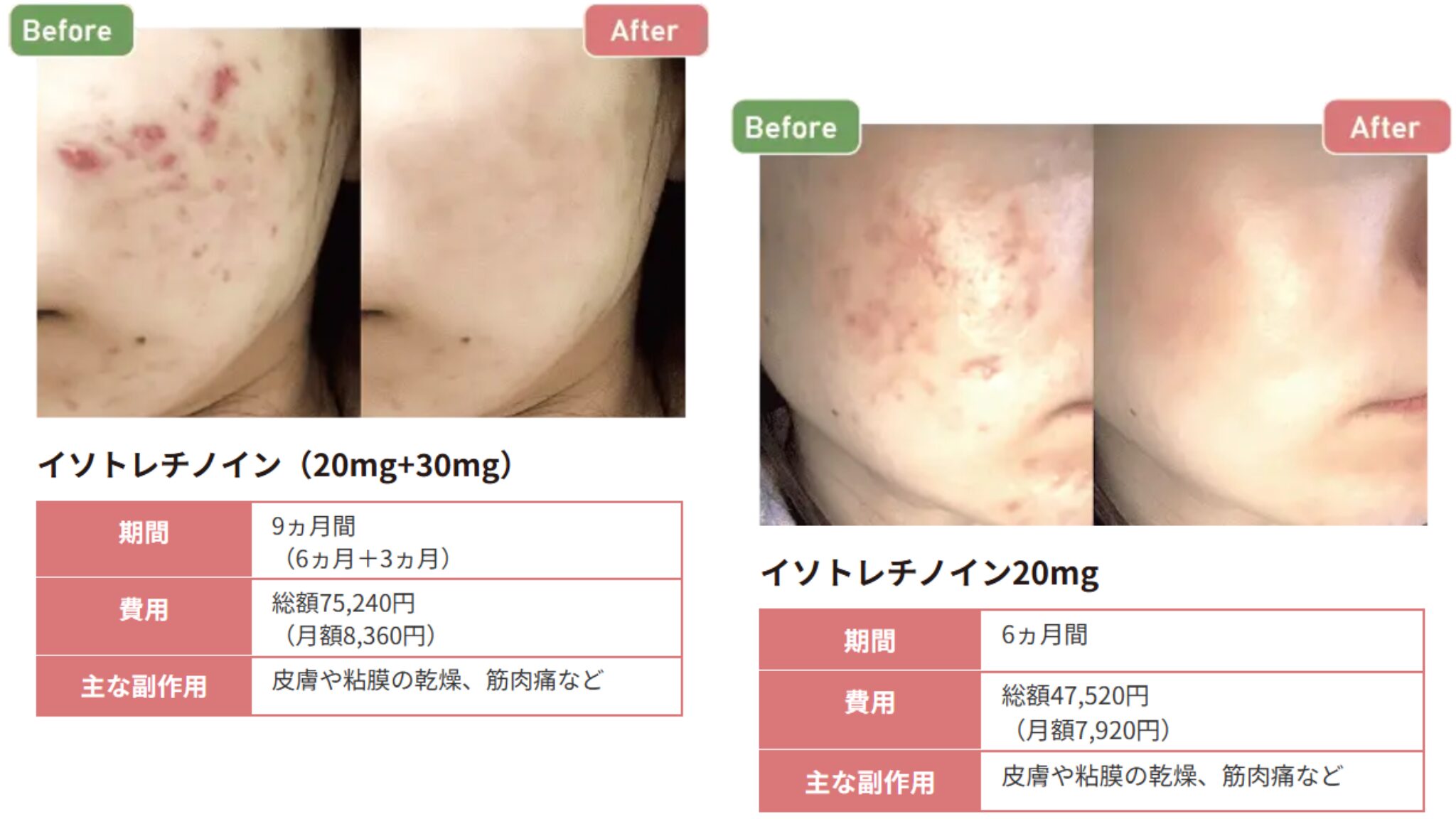 フィットクリニックの症例写真