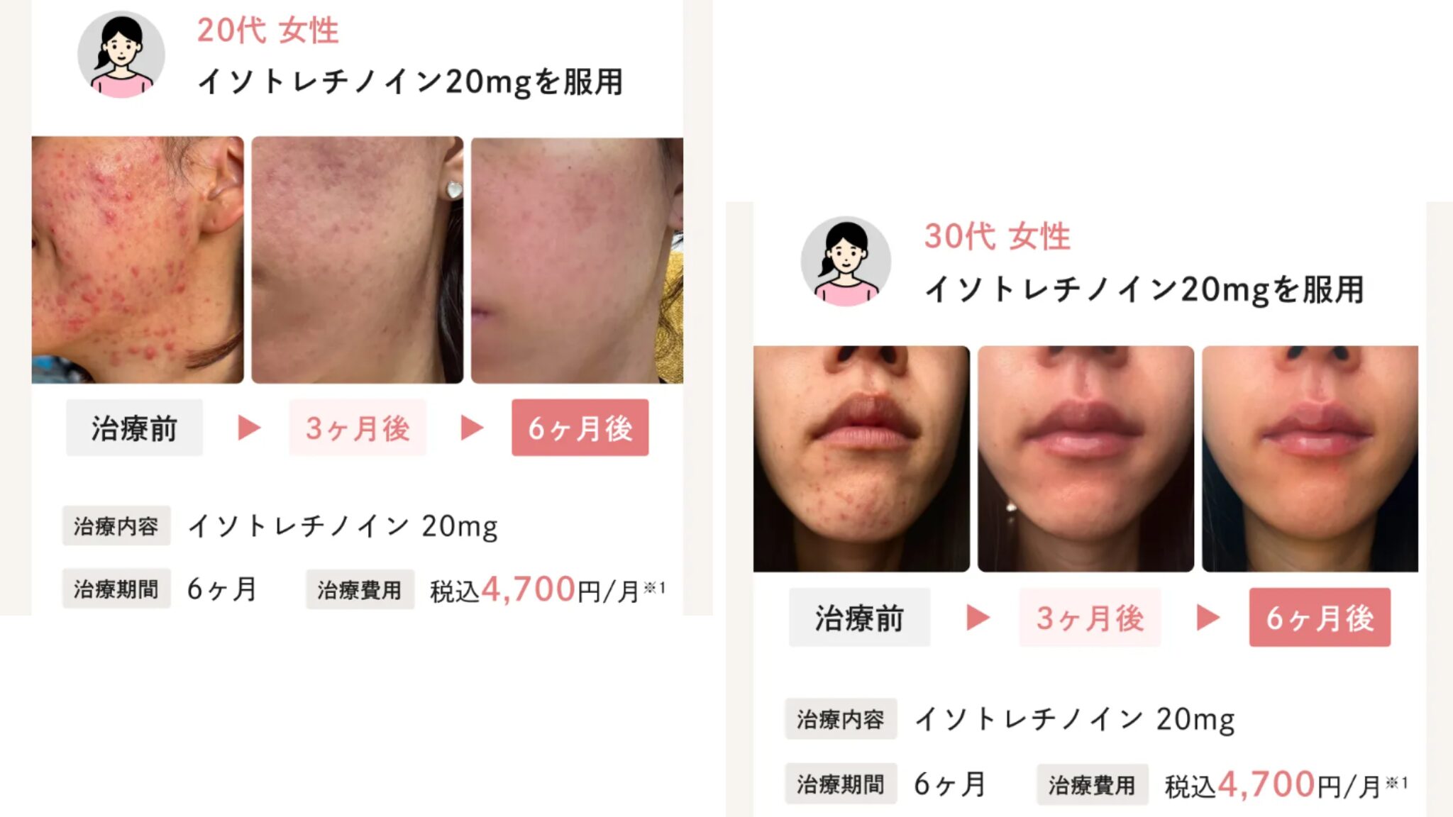 Actually,の症例写真