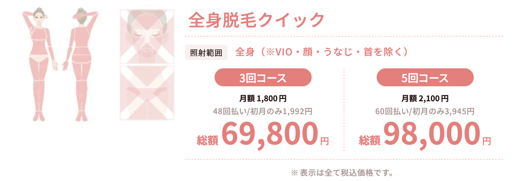 TCBクイック脱毛