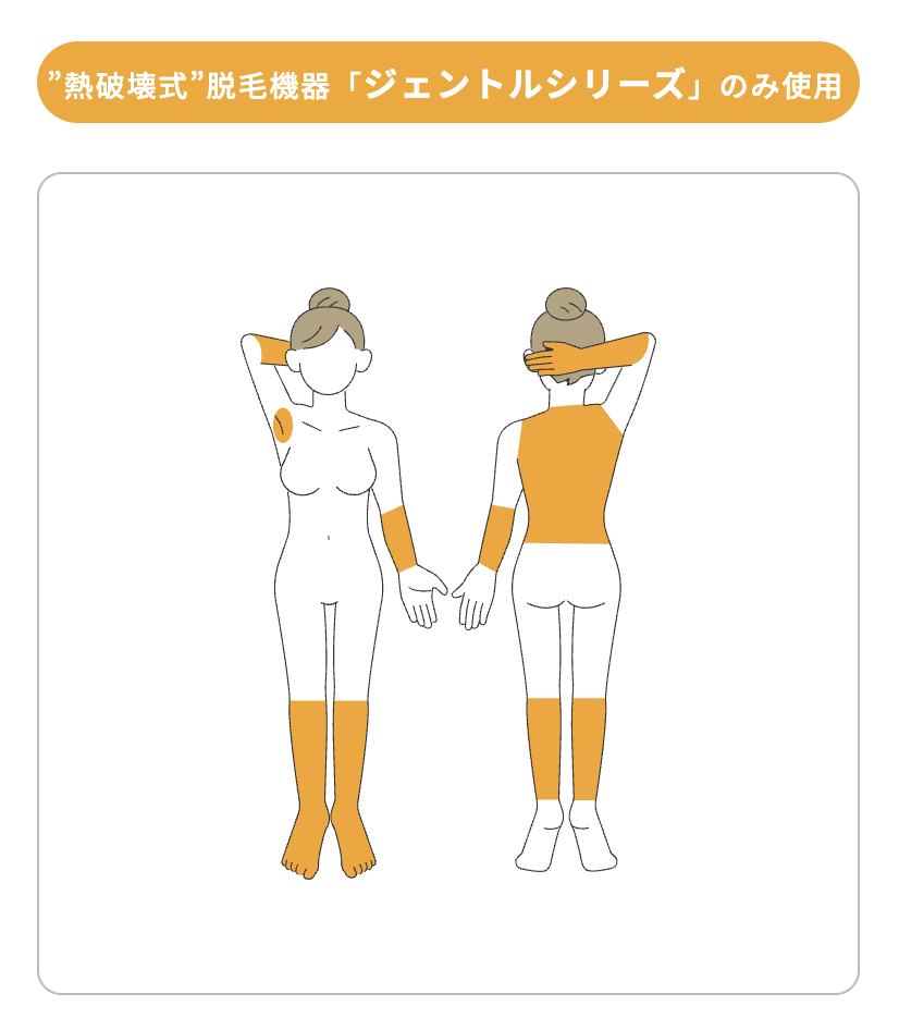 見える範囲だけで賢く安く！ライト全身脱毛を選ぶ！