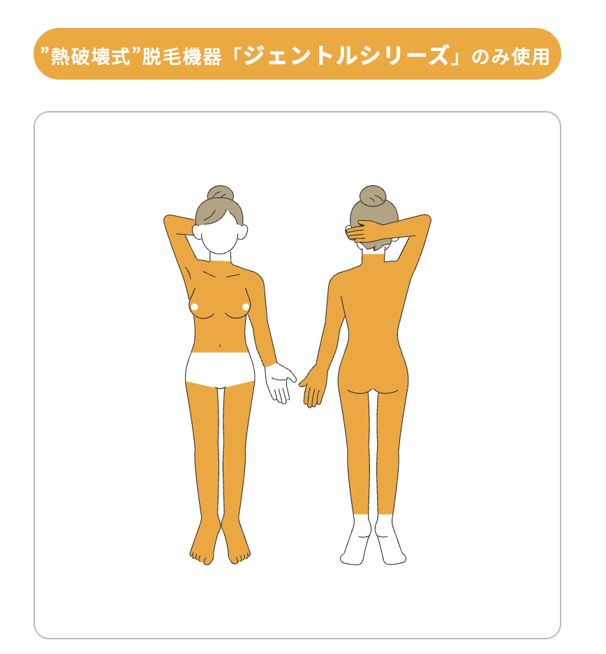 一番人気！全部おまかせ「全身脱毛」を選ぶ！