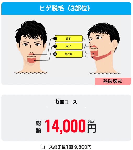 メンズリゼ_ヒゲ脱毛_3部位