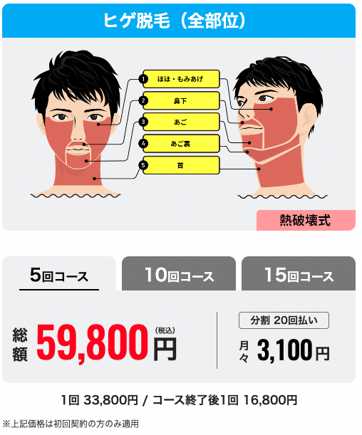 メンズリゼ_ヒゲ脱毛_10部位_5回