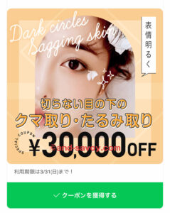 TCB目の下のクマ取りクーポン