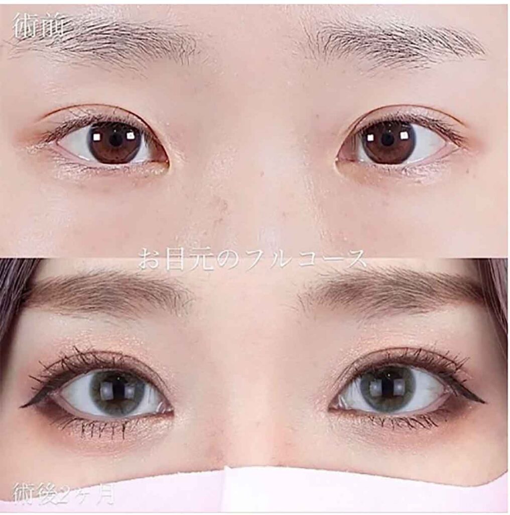 モニターの症例写真(部分・モザイクなし)