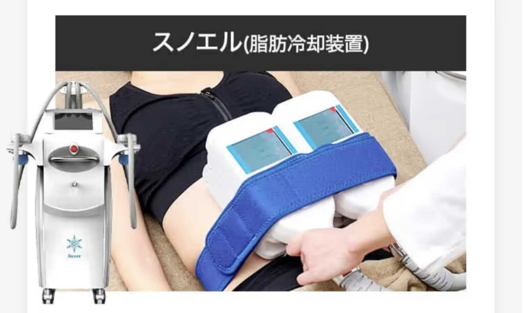 スノエル(脂肪冷却)