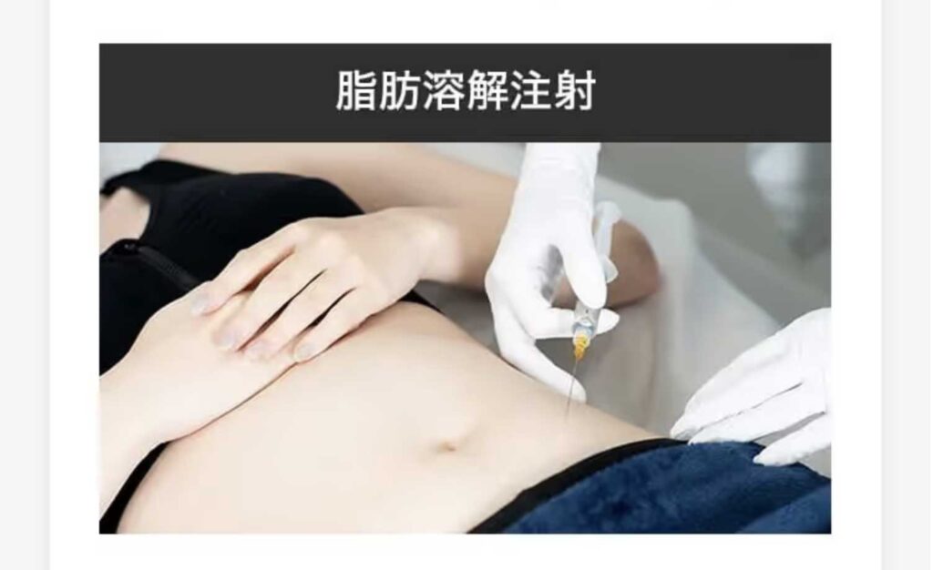 脂肪溶解注射