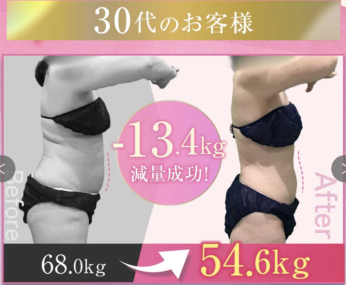 URARAクリニックのビフォーアフター(30代)