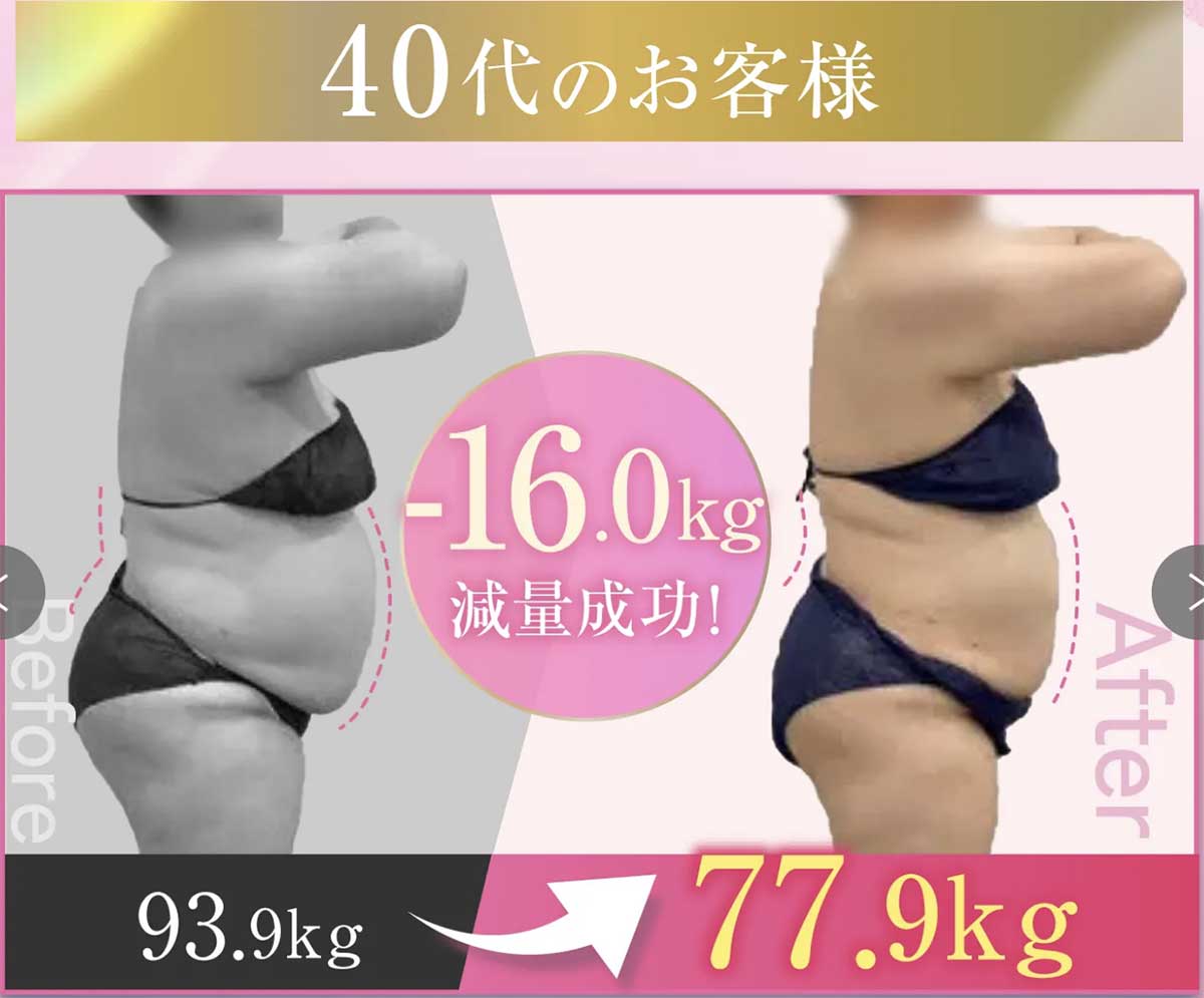 URARAクリニックのビフォーアフター(40代)