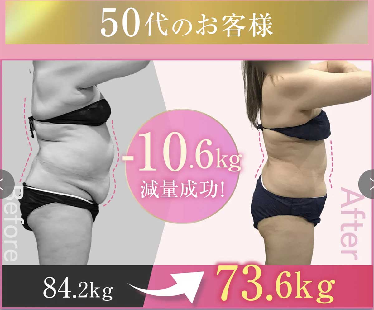 URARAクリニックのビフォーアフター(50代)