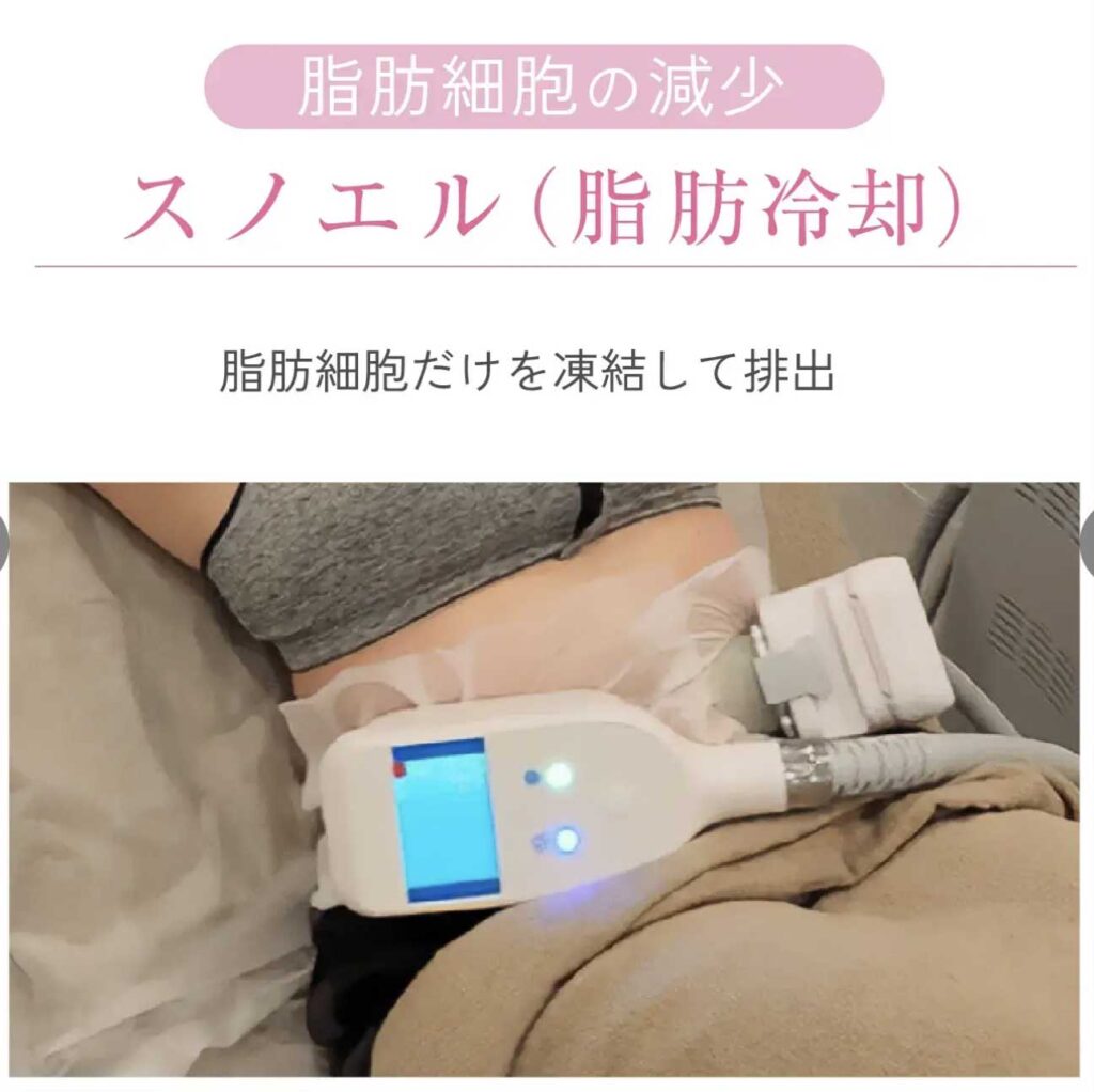 脂肪冷却マシン「スノエル」