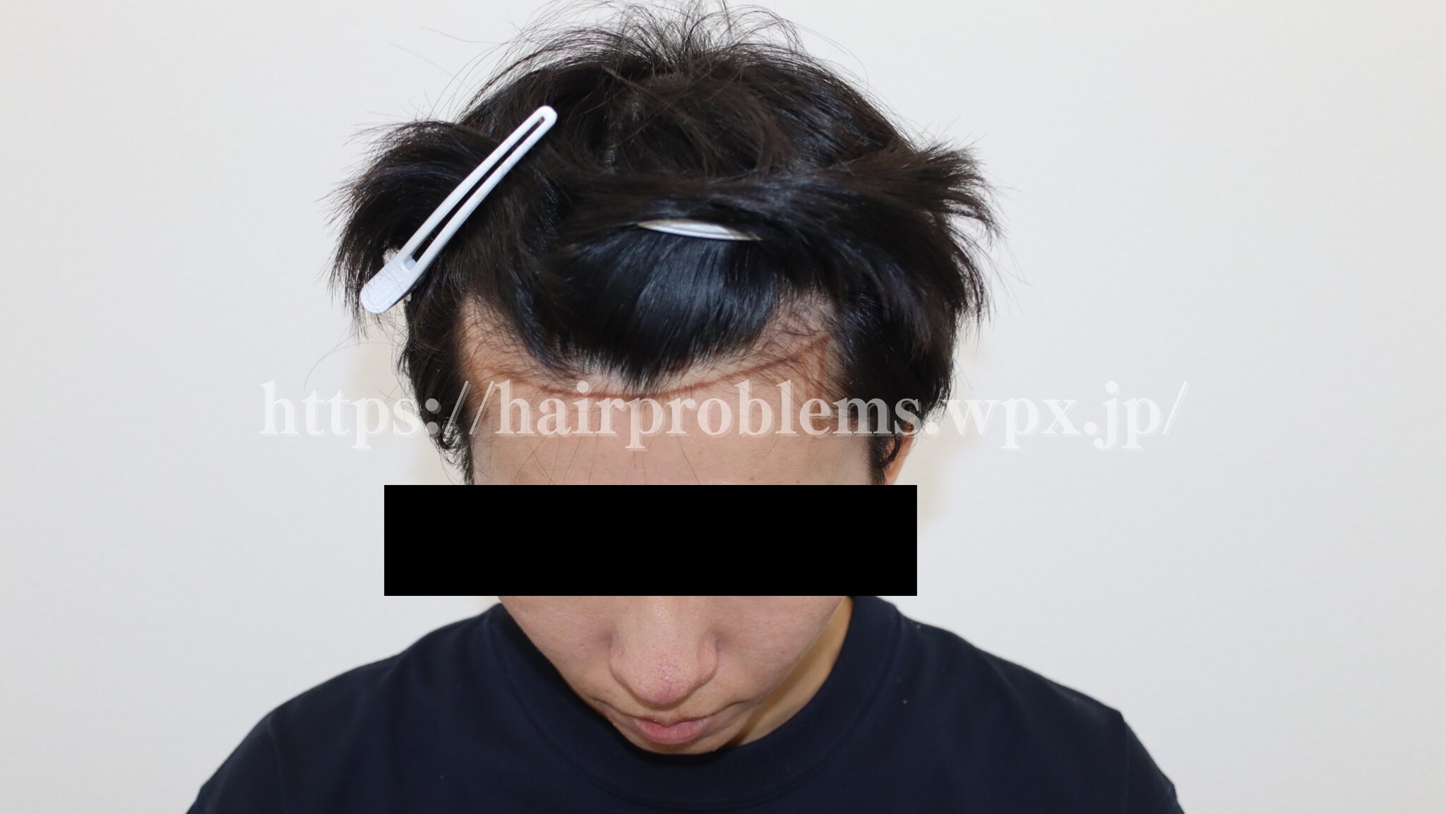 実際にデザインを書いてもらった時の様子