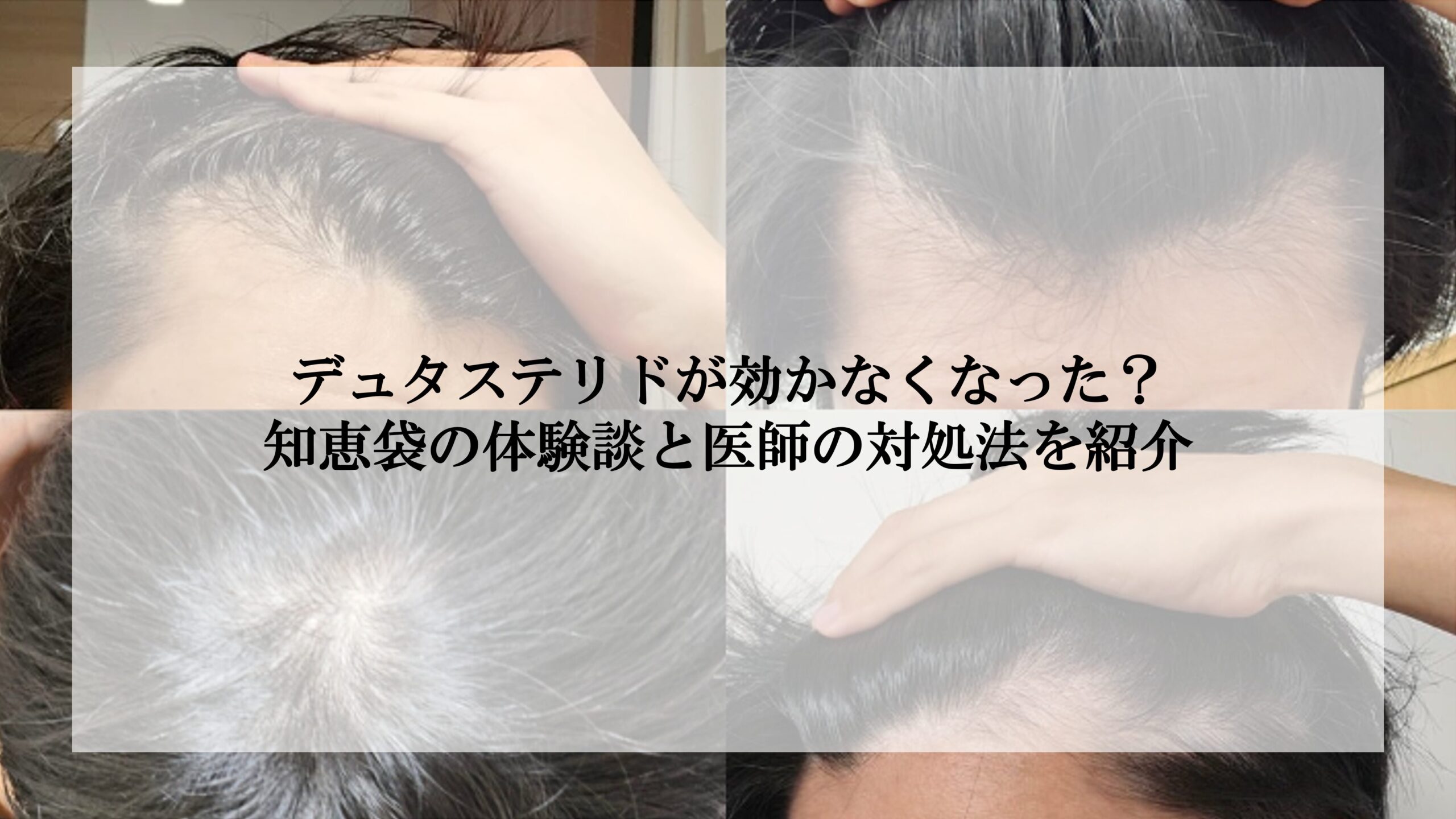 デュタステリドが効かなくなった？知恵袋の体験談と医師の対処法を紹介 