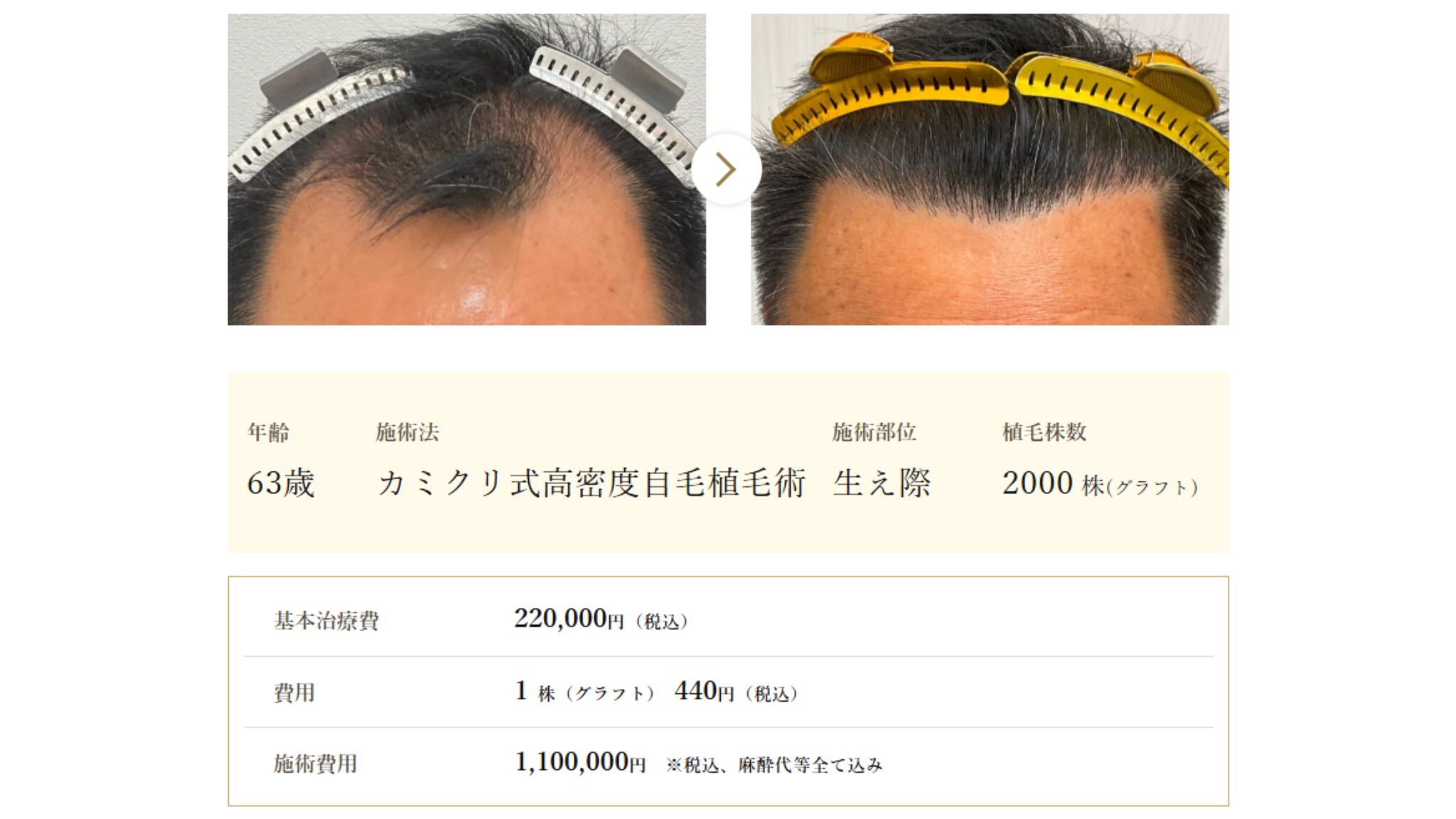 カミノクリニックの症例写真