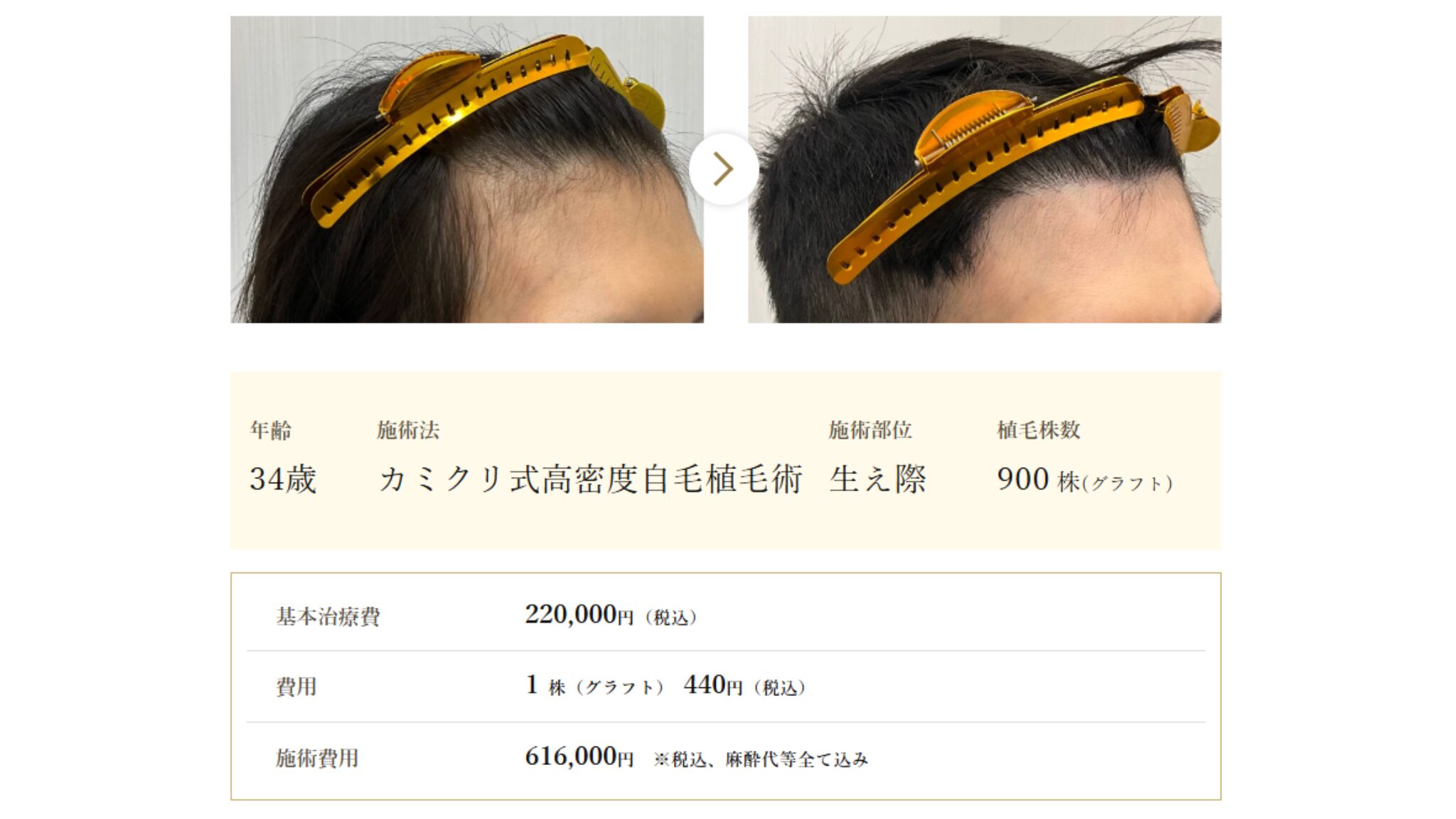 カミノクリニックの症例写真