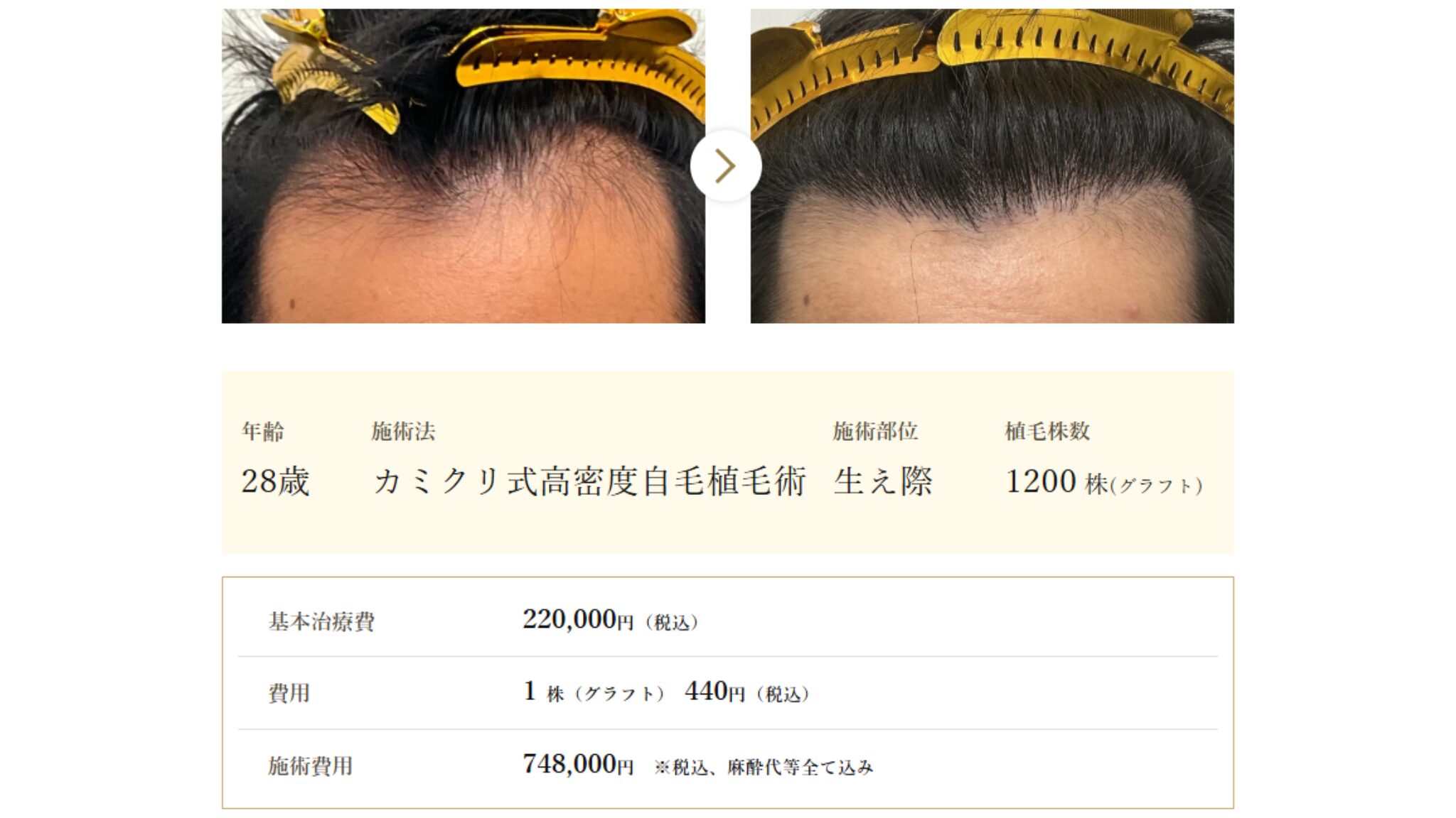 カミノクリニックの症例写真