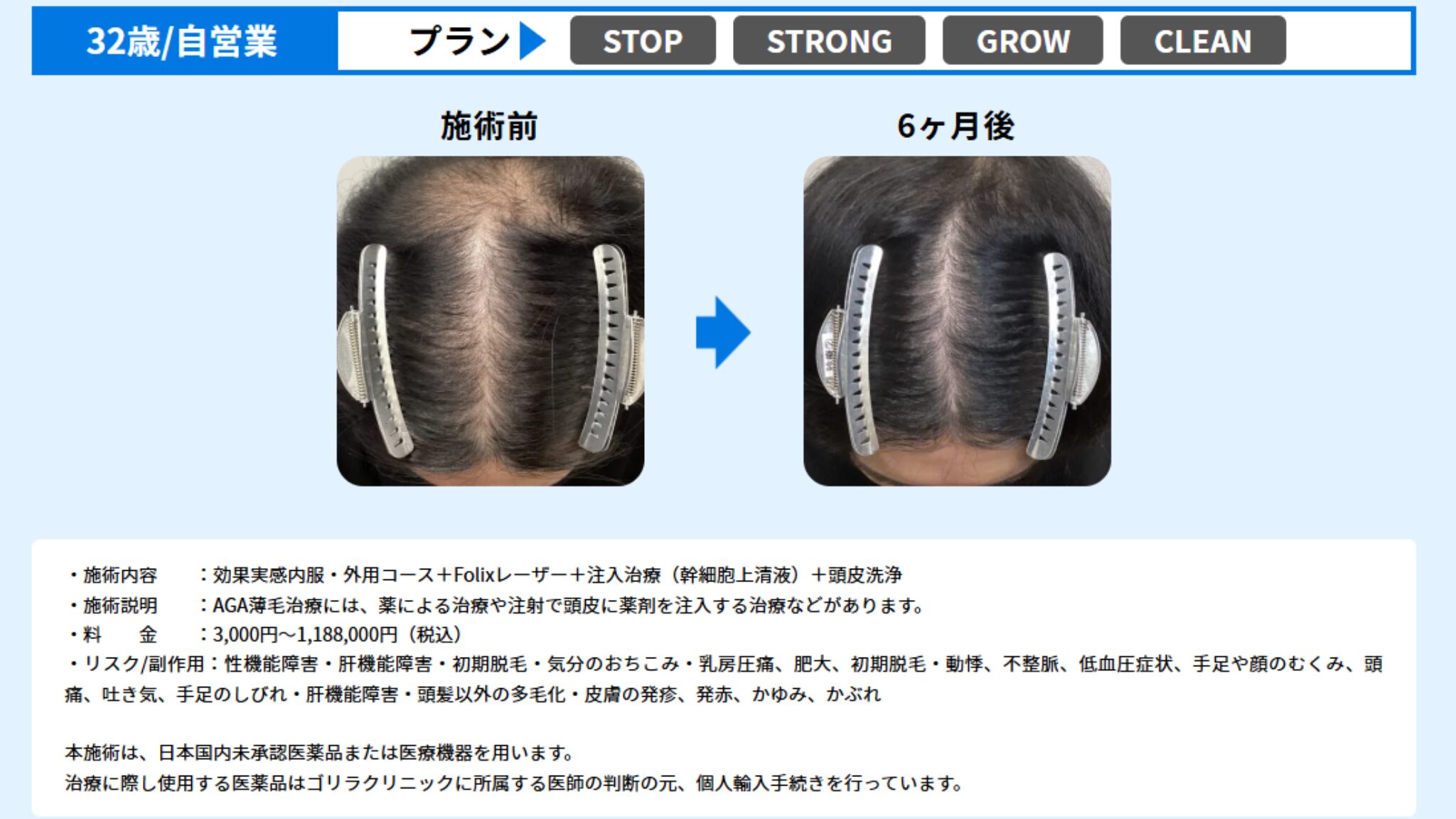 ゴリラクリニックの症例写真