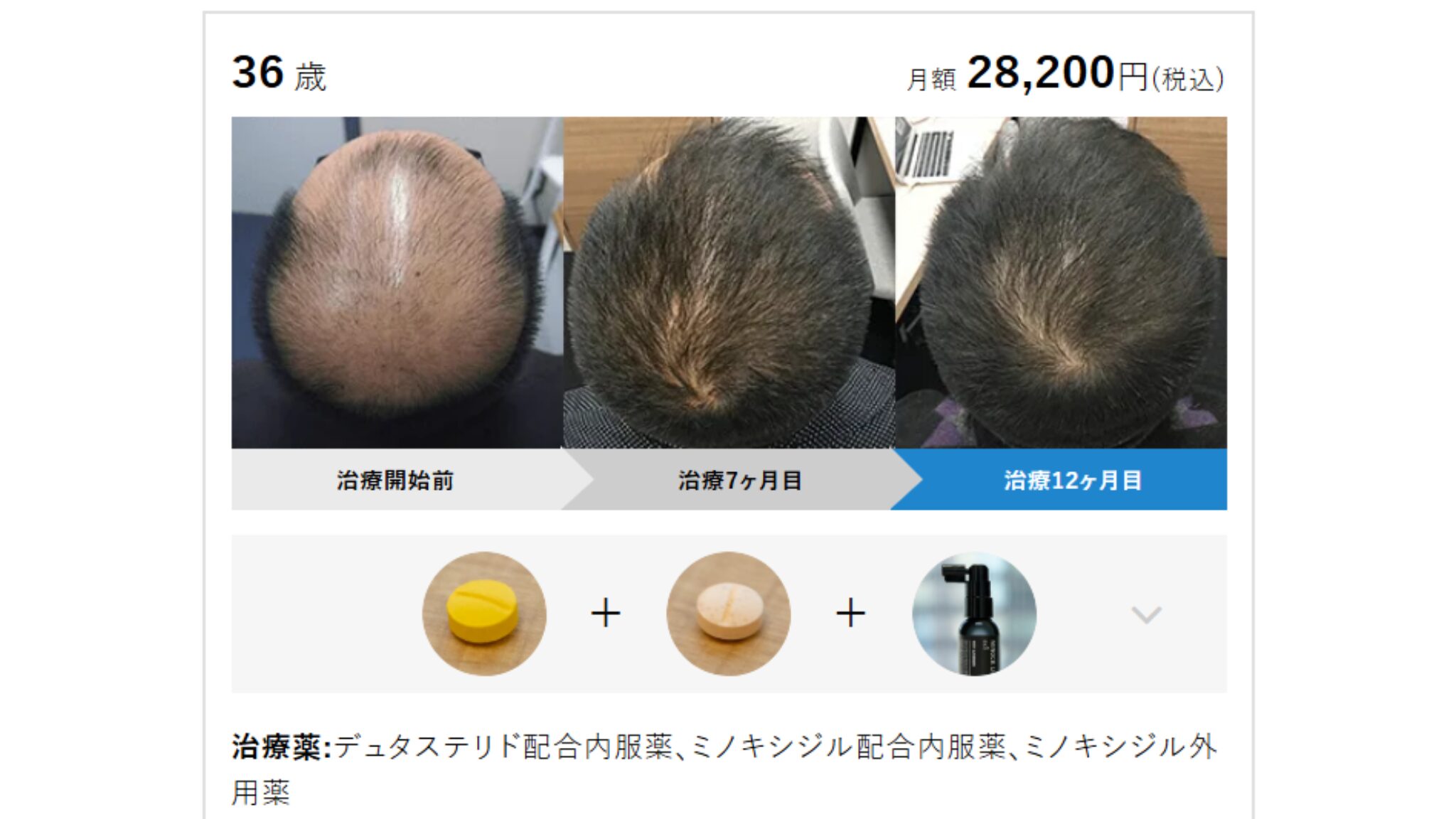 AHCメディカルサロンの症例写真