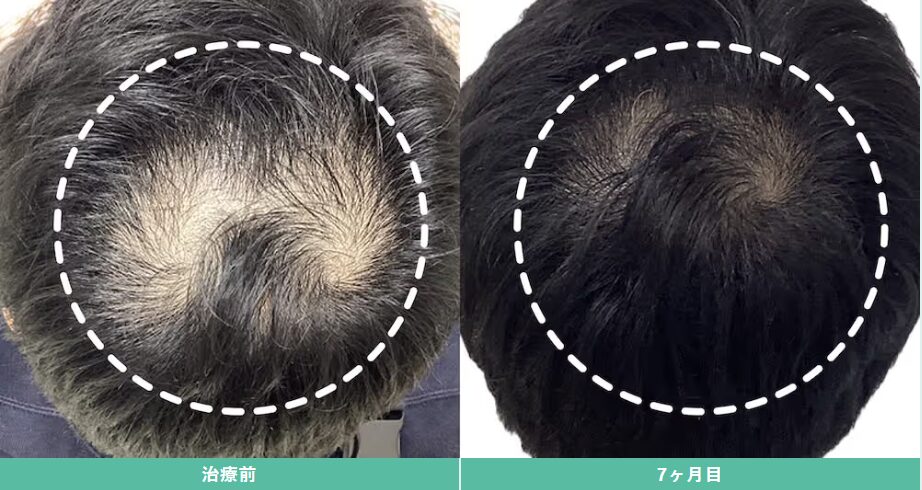 Dr.AGAクリニックの症例写真