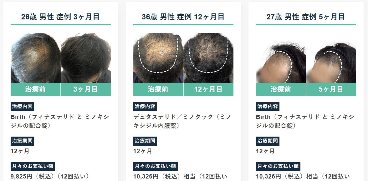 Dr.AGAクリニックの症例写真