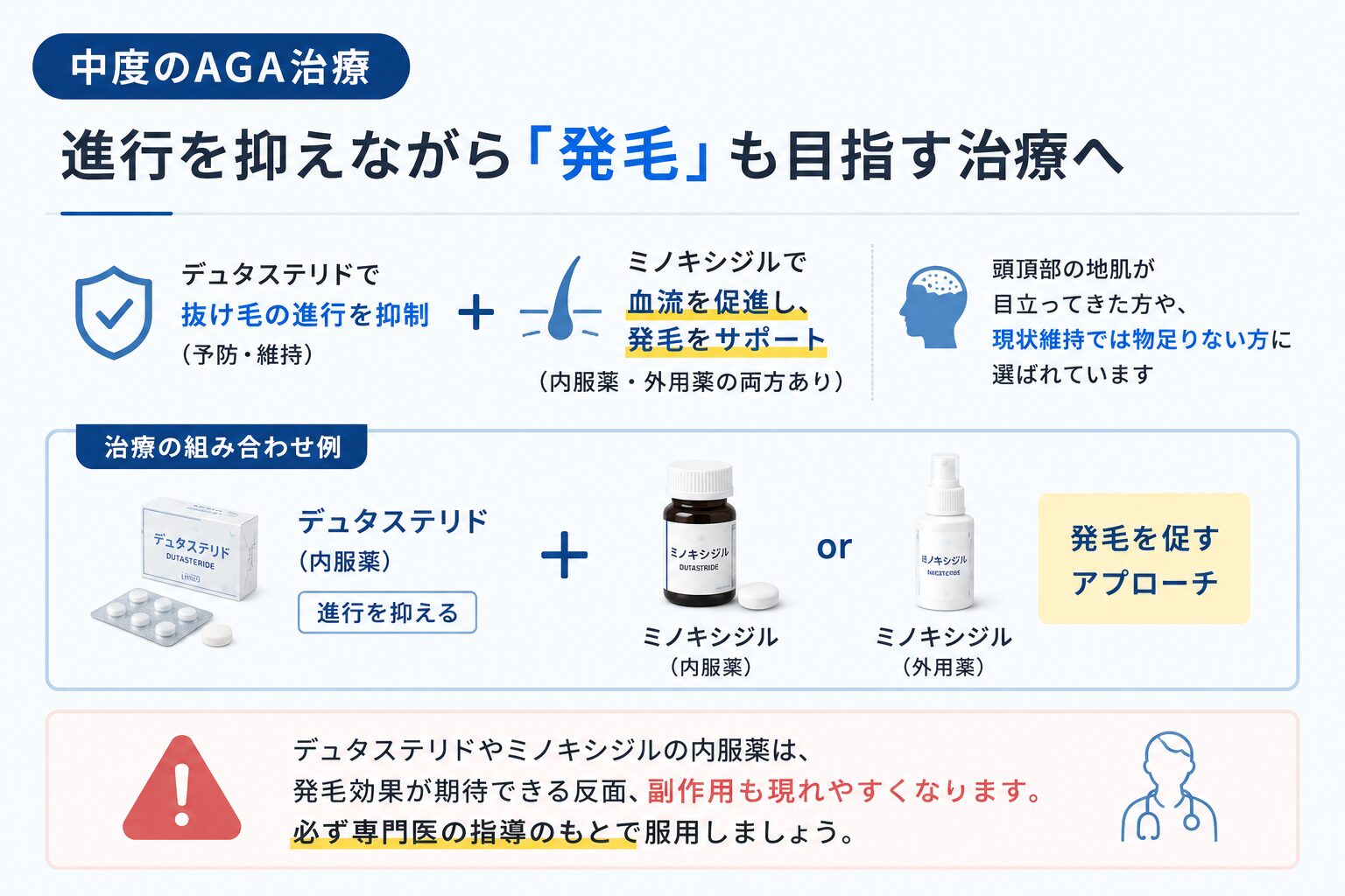 中度のAGA治療:デュタステリドやミノキシジルの内服薬or外用薬を組み合わせる