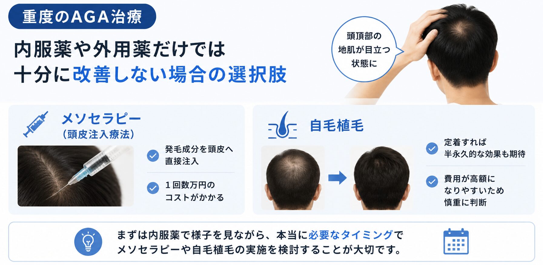 重度のAGA治療:メソセラピー(頭皮注入療法)や自毛植毛の検討