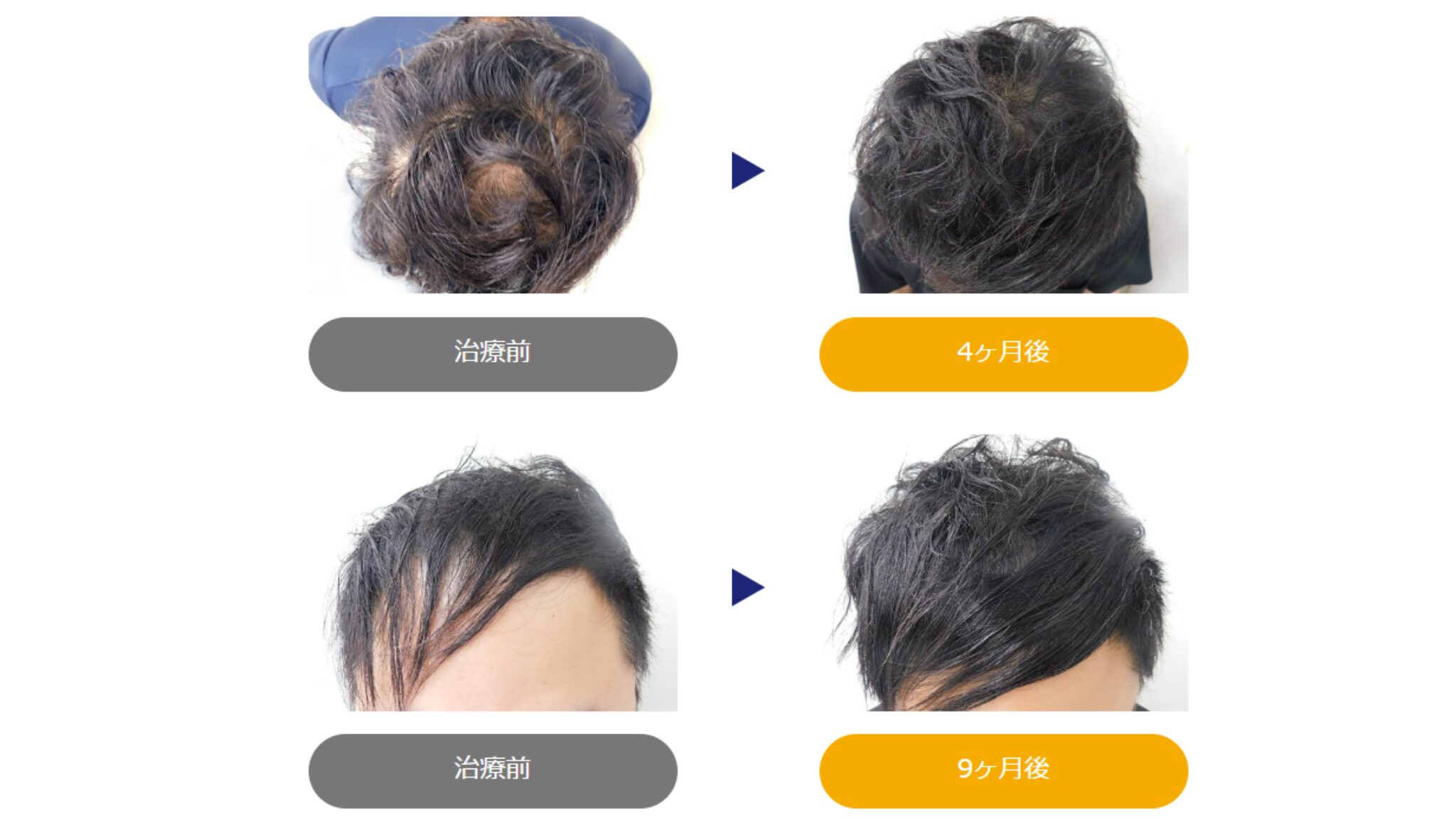 イースト駅前クリニックの症例写真