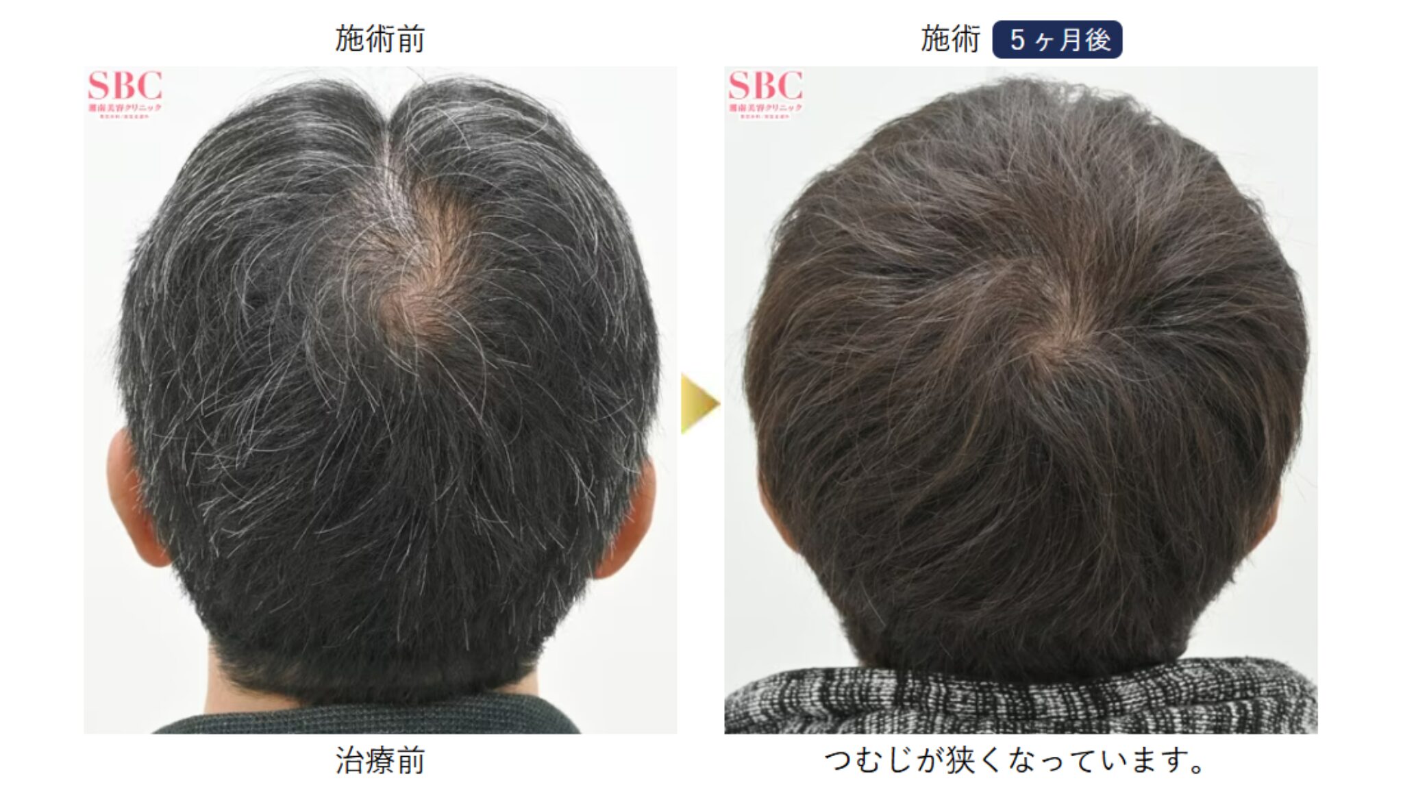 湘南AGAクリニックの症例写真